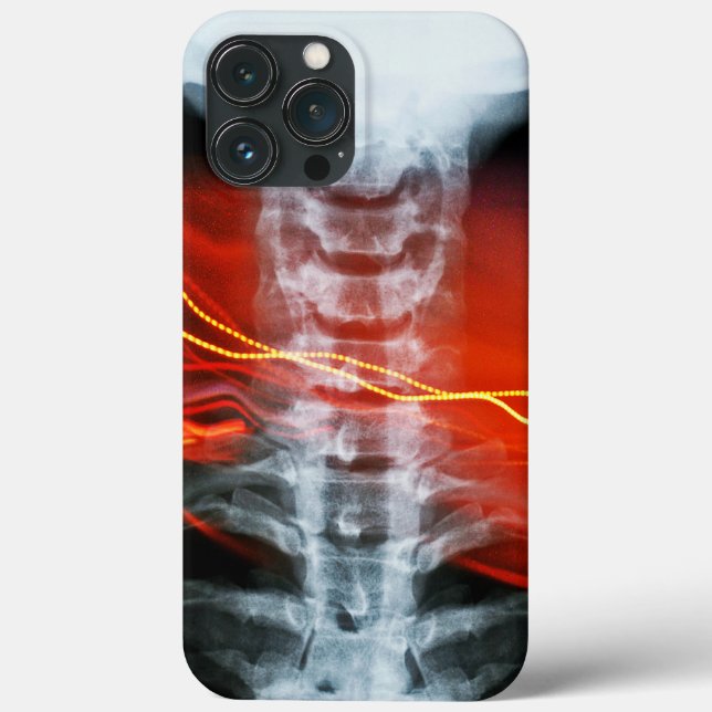 Coques Case-Mate iPhone Boîtier de téléphone numérique X-Ray (Verso)