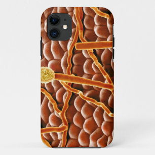 Coque iPhone 11 Champignon de rouille pulvérulente sur la