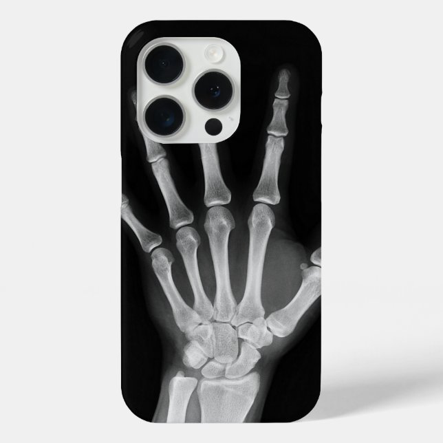 Coques Case-Mate iPhone Housse Skeleton iPhone 15 pro (Verso)