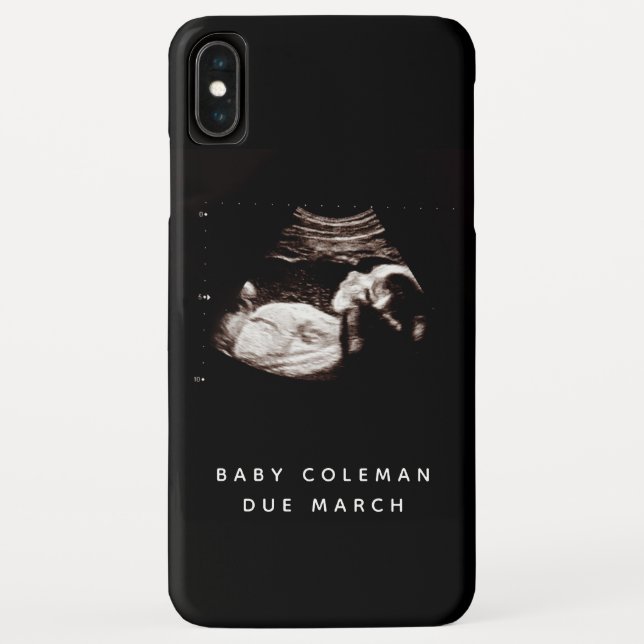 Coques Case-Mate iPhone Pregnancy Baby Sonogramme Ultrasound Photo (Dos)