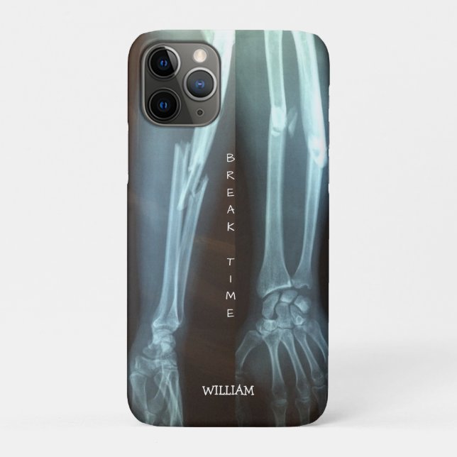 Coques Case-Mate iPhone Rayon cassé et Ulna Xray "Temps de pause"    (Dos)