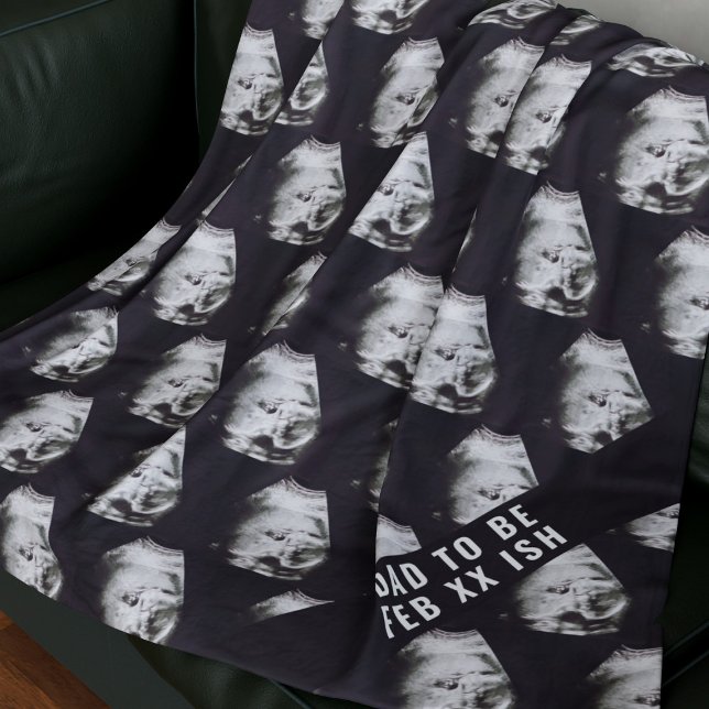 Couverture Polaire Papa to Be Ultrasound Photo Premier cadeau de Fête (A fun blanket for the Dad to be. Upload your sonagram photo and add a due date)
