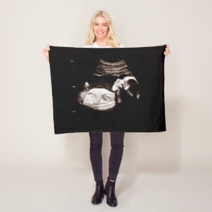 Couverture Polaire Sonogramme de l'échographie de bébé de garde de