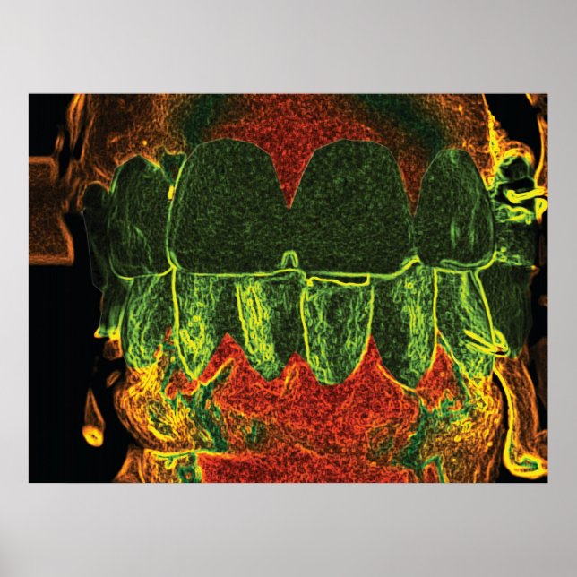 Crazy Teeth Bite Dentist Orthodontist Poster (Vorne)