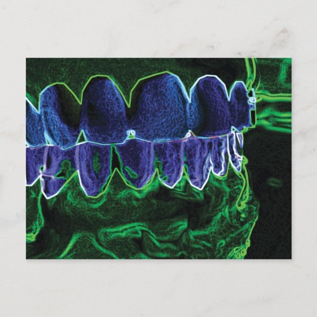 Crazy Teeth Model Dentist Orthodontist Card Postkarte (Vorderseite)