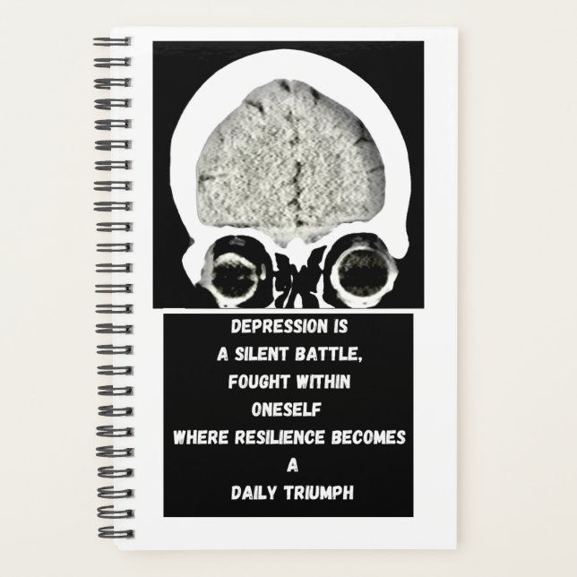 CT Scan_CTFOD_Dailicher Triumph Planer (Vorderseite)