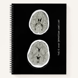 CT Scan_CTFOD_ So sieht Depression aus Notizbuch