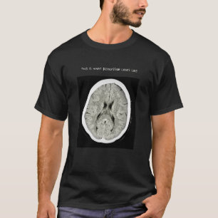 CT Scan_ CTFOD_So sieht Depression aus T-Shirt