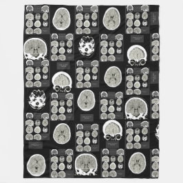 CT Scan_this is depression_BLK_CTFOD Fleecedecke