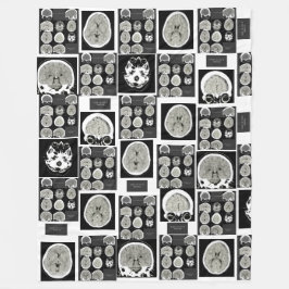 CT Scan_this is depression_CTFOD Fleecedecke