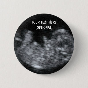 Custom Baby Ultrasound Picture Button