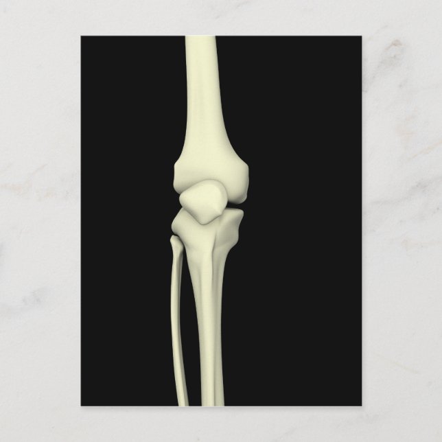 Darstellung des Knie-Knochens, gerade Postkarte (Vorderseite)