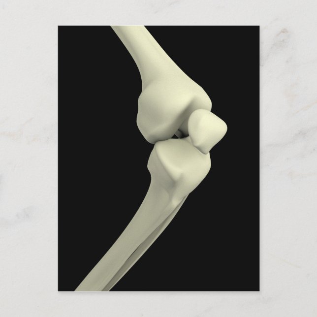 Darstellung des Knie-Knochens Postkarte (Vorderseite)