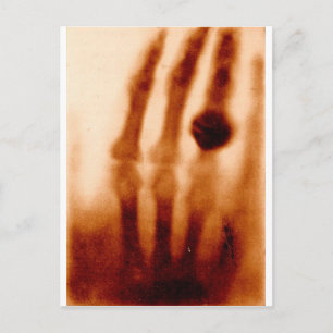 Das erste X-Ray, 1901, Foto Postkarte