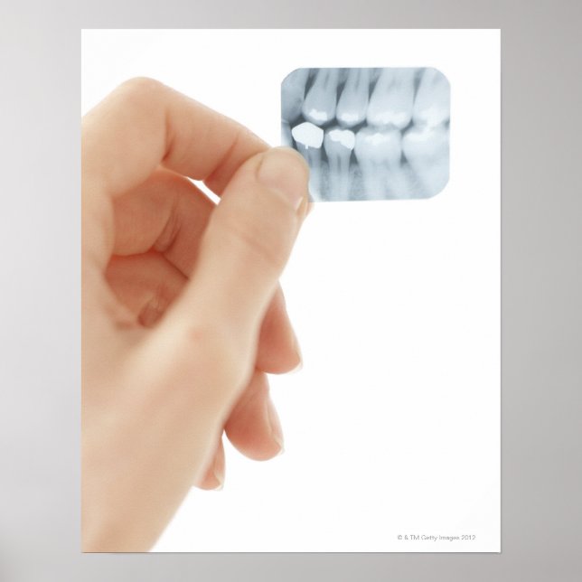 DAS MODELL WURDE FREIGEGEBEN. Zahnröntgen. Poster (Vorne)