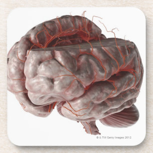 Dessous-de-verre Artères du cerveau 3