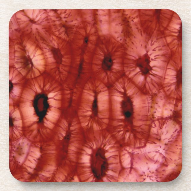 Dessous-de-verre Cellules de Sclerenchyma d'un puits de cerise (Devant)