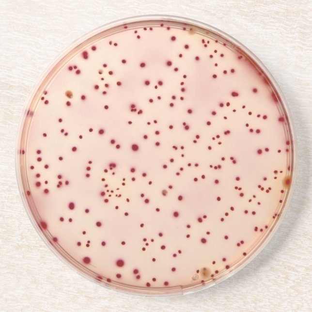 Dessous de verre de boîte de Pétri (Devant)