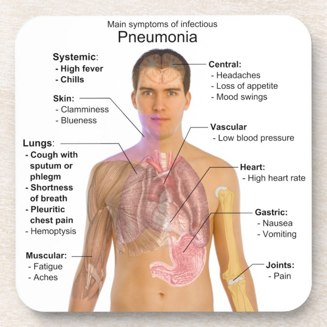Dessous-de-verre Diagramme des symptômes de la pneumonie (Devant)
