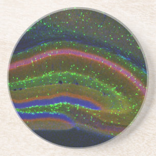 Dessous De Verre En Grès Interneuron 6