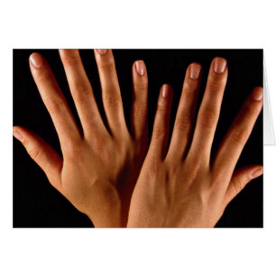 Deux mains croisées