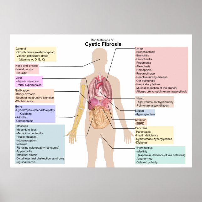 Diagramm der Manifestationen der zystischen Fibros Poster (Vorne)