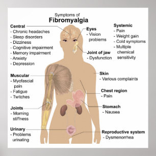 Diagramm Gemeinsame Anzeichen + Symptome Fibromyal Poster