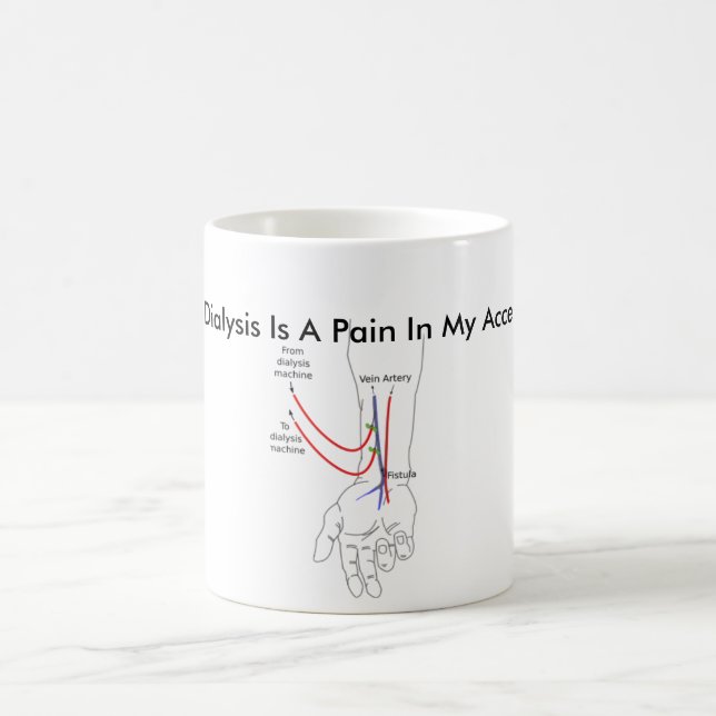 Dialyse ist Schmerz in meinem Zugang Kaffeetasse (Mittel)