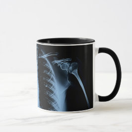 Die Röntgenaufnahme Tasse