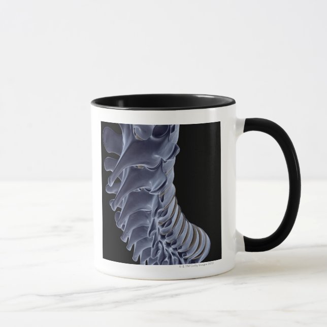 Die vertebrale Spalte Tasse (Rechts)
