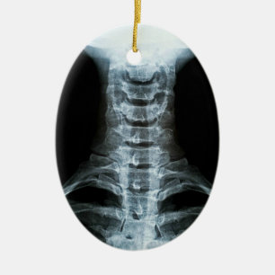 Digital-Röntgenstrahl-Kunst (Gewohnheits-hinterer Keramik Ornament