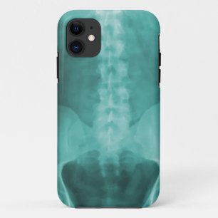 Digital-Röntgenstrahl-Kunst iPhone 5 Fall Case-Mate iPhone Hülle