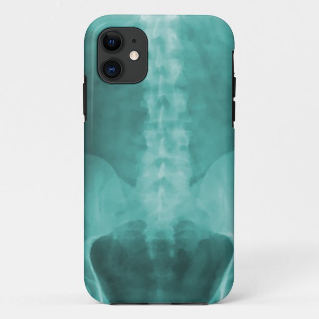 Digital-Röntgenstrahl-Kunst iPhone 5 Fall Case-Mate iPhone Hülle (Rückseite)