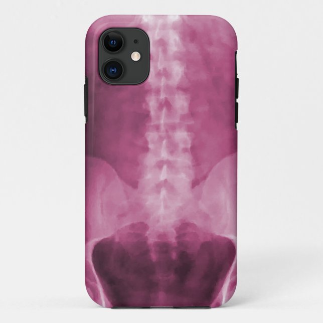 Digital-Röntgenstrahl-Kunst iPhone 5 Fall Case-Mate iPhone Hülle (Rückseite)