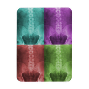 Digital-Röntgenstrahl-Kunst-Prämien-Magnet Magnet