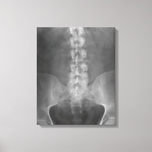 Digital X-Ray Art Wrapped Canvas Leinwanddruck