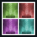 Digital X-Ray Pop Art Square Poster<br><div class="desc">Das Design bietet vier verschiedene farbige Versionen eines digital verbesserten und veredelten ap lumbopelvic Röntgenstrahls.</div>