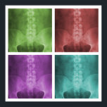 Digital X-Ray Pop Art Square Poster<br><div class="desc">Das Design bietet vier verschiedene farbige Versionen eines digital verbesserten und veredelten ap lumbopelvic Röntgenstrahls.</div>