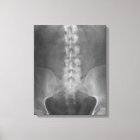 Digitale Ray Art Wrapped Canvas