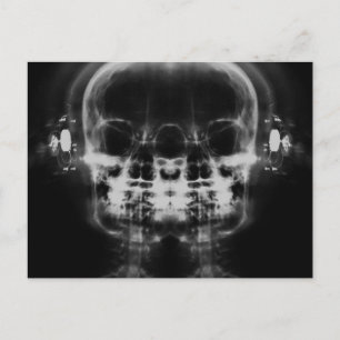 Doppel-X-Ray-Skulls mit Kopfhörern - B&W Postkarte