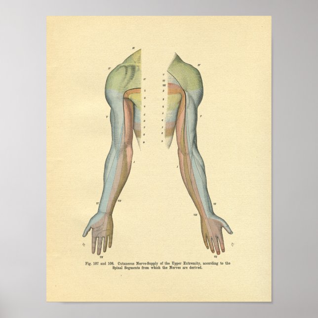 Druck am menschlichen Arm Kutane Nervenenerkrankun Poster (Vorne)