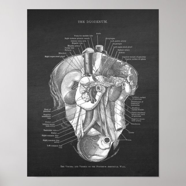 Duodenum Anatomie Art Gastroenterologe Wall Deco Poster (Vorne)