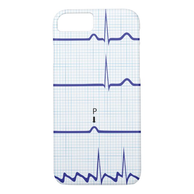 ECG/EKG iPhone Fall Case-Mate iPhone Hülle (Rückseite)