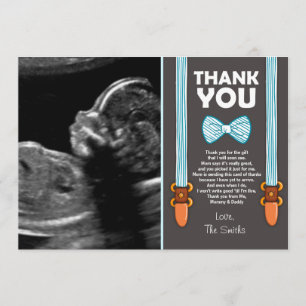 Écho d'homme de carte de remerciements de baby