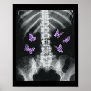 Egirl Röntgen-Skelett Rosa Schmetterling Harajuku Poster