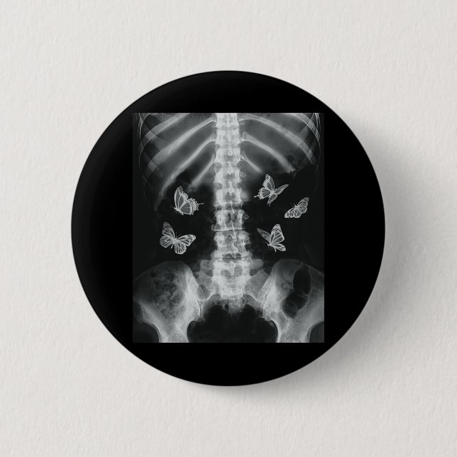Egirl Skeleton Xray Butterfly Harajuku y2k Dark Ed Button (Vorderseite)