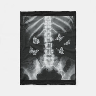 Egirl Skeleton Xray Butterfly Harajuku Y2k Dark Ed Fleecedecke