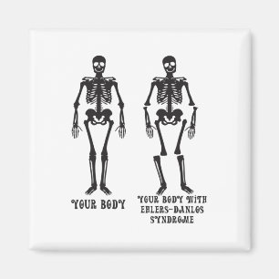 Ehlers - Ihr Körper mit dem Ehlers Danlos Syndrom  Magnet