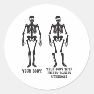 Ehlers - Ihr Körper mit dem Ehlers Danlos Syndrom  Runder Aufkleber
