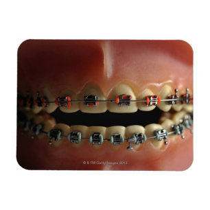 Ein zahnmedizinisches Modell und Zahnklammern Magnet
